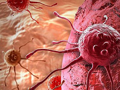 Xərçəngə səbəb olan qidalar - 