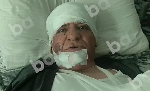 Nərimanovdakı partlayışda yaralanan şəxs: "Hamı töküldü üstümə, məni qan aparırdı" - 