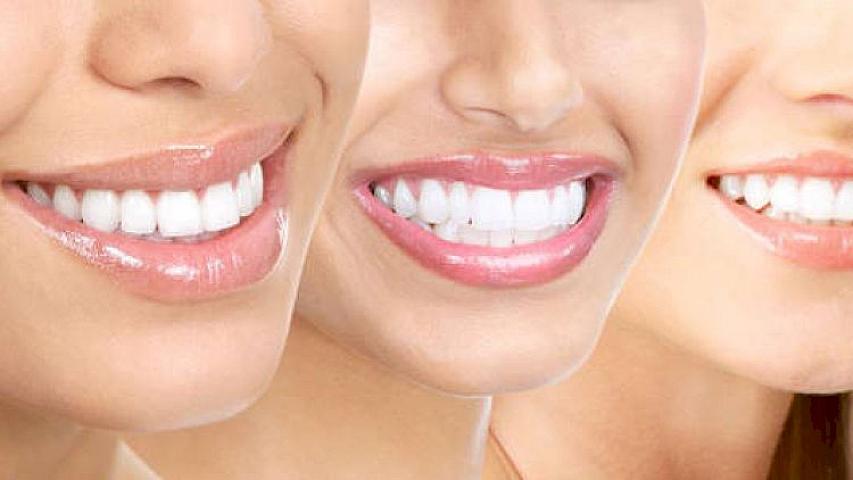 Dişlərinizi bu üsullarla evdə qar kimi ağardın - 
