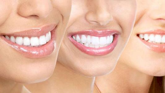 Dişlərinizi bu üsullarla evdə qar kimi ağardın - 