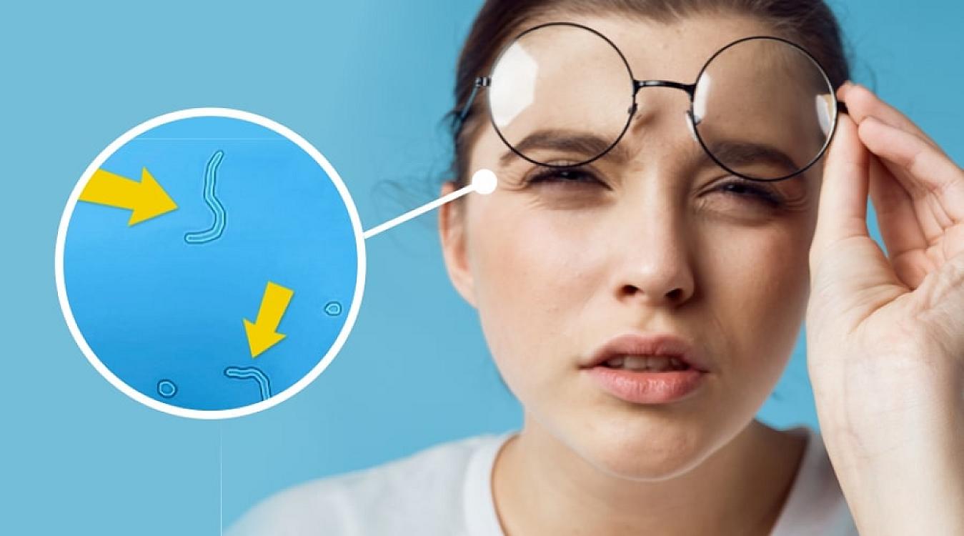 Gözlərə görünən ləkələr