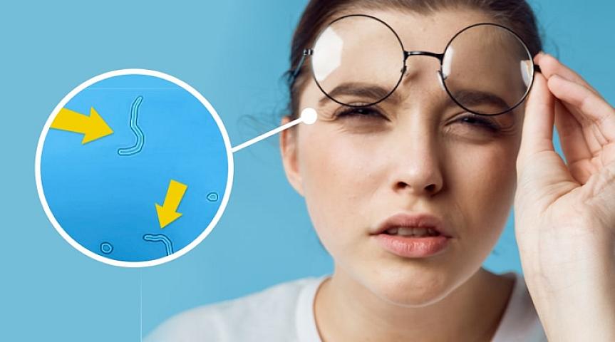 Gözlərə görünən ləkələr