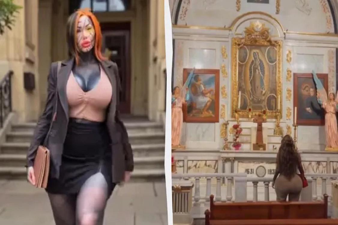 Görünüşünü tamamilə dəyişdirən qalmaqalı 