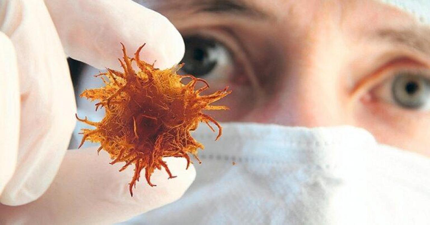 Xərçəngin müalicəsi ilə bağlı