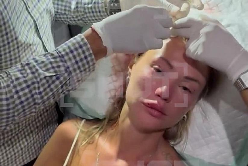 Başına şüşə butulka vurdular,