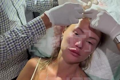 Başına şüşə butulka vurdular,