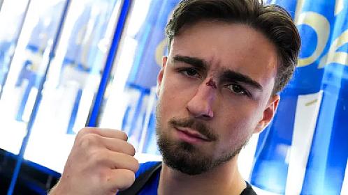 Oyuna burnu sınıq halda davam etdi,