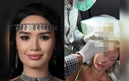 Qazaxıstanlı model rus bloqerin başına stəkan çırpdı - 