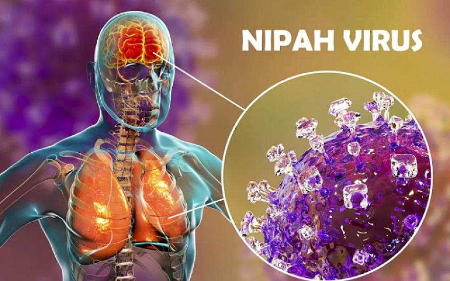 Azərbaycanda "Nipah"a yoluxma qeydə alınmayıb - 