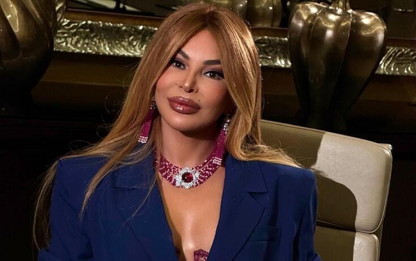 Aygün Kazımova özünü "10 yaş cavanlaşdırdı" - 