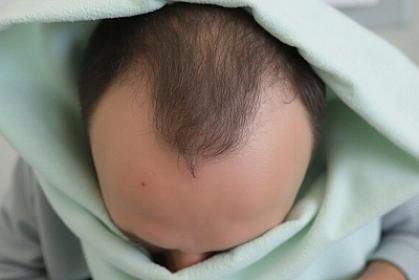 Saç əkimi zamanı faciə: 