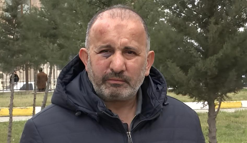 Избитый сотрудник "Азеригаз": "Говорил, бей до смерти"