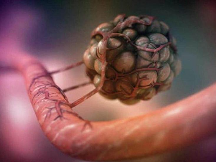 A new era in cancer treatment: Complete recovery without chemotherapy