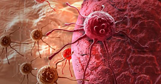 Xərçəngə səbəb olan pəhriz –