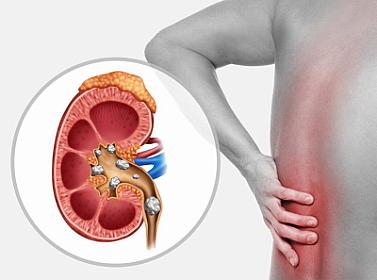 Hər gün bir ovuc yeyin: 