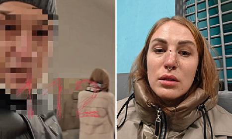 Moskva metrosunda dəhşət: pul istədi, 