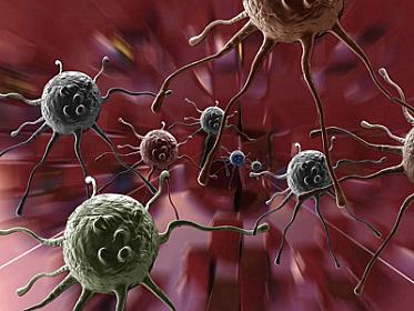 Zərərsiz bildiyimiz vərdişlər xərçəngə aparır - 