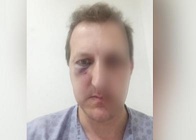 Əməkdar artistdən oğlunu döyənlərin həbs edilməməsinə 