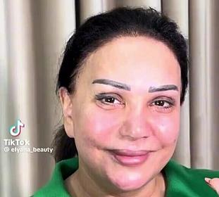 Azərbaycanlı müğənninin makiyajsız halı MÜZAKİRƏ YARATDI - 