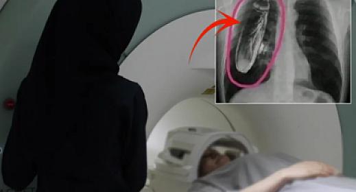 Bədənində "canlı tarakan var" dedilər, həqiqət isə başqa imiş - 