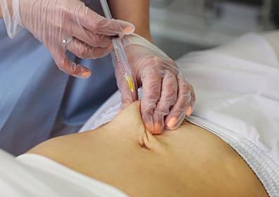 Qadınlar arasında 17 min manatlıq bu əməliyyat növünə maraq yaranıb