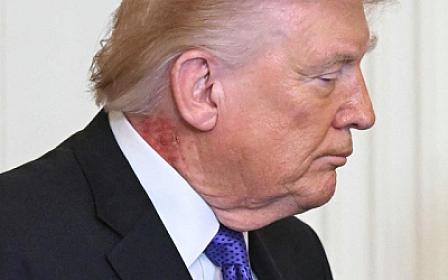 Tramp boynundakı qəribə ləkə ilə