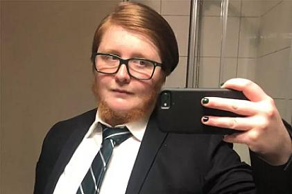 Qadın saqqalını qırxmağı dayandırdı: necə göründüyünü 