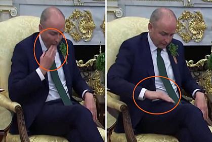 Şalvarındakı ləkəni tüpürcəyi ilə sildi - 