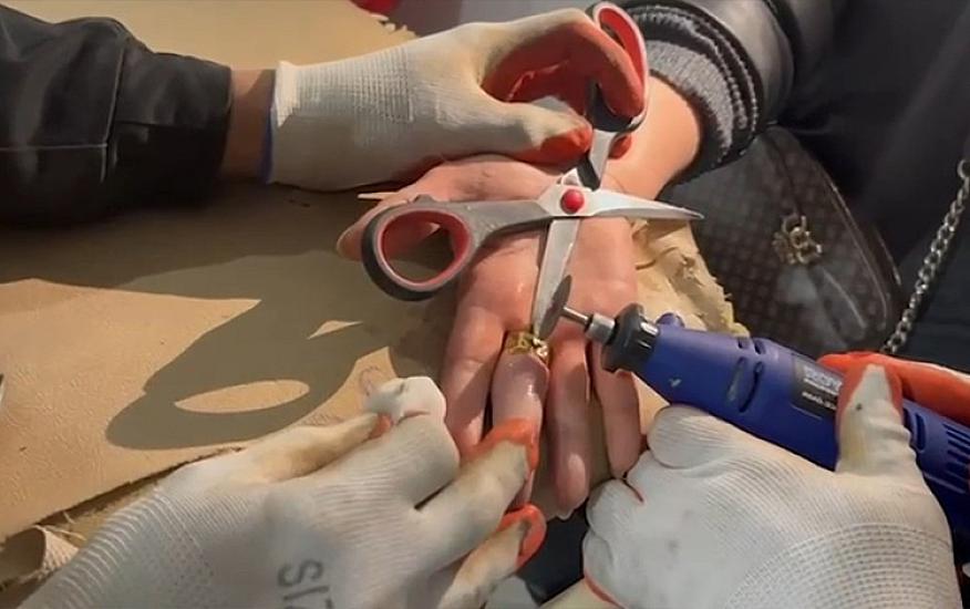 Barmağında sıxışan üzüyü belə çıxardılar - 