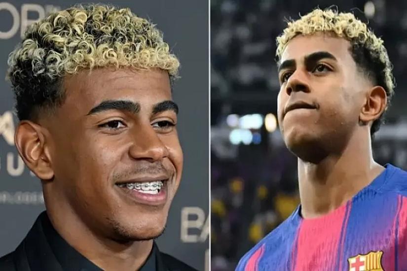 Yamalın müqaviləsində "Qızıl top"la bağlı xüsusi bənd var: 