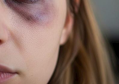 Bakıda aktyorun anası döyüldü — 