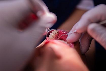 Разрушающий зубную пломбу