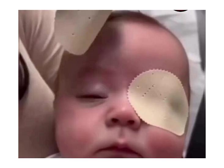 Əməliyyatdan sonra körpənin ilk dəfə anasını gördüyü ANLAR - 