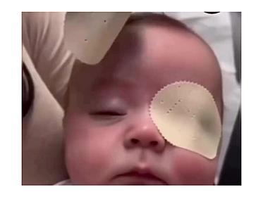 МОМЕНТЫ, КОГДА РЕБЕНОК ВПЕРВЫЕ УВИДЕЛ МАМУ ПОСЛЕ ОПЕРАЦИИ -