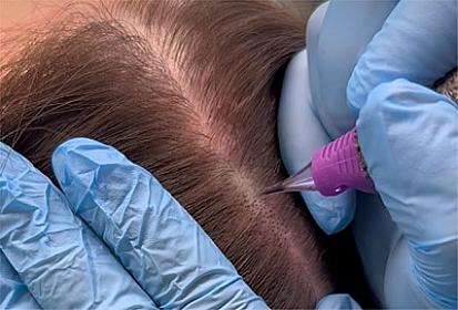 Bloger saç ayırımını 