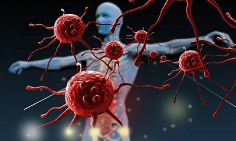 Xərçəngi erkən aşkar etməyin 