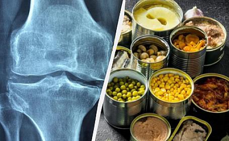 These are food bones