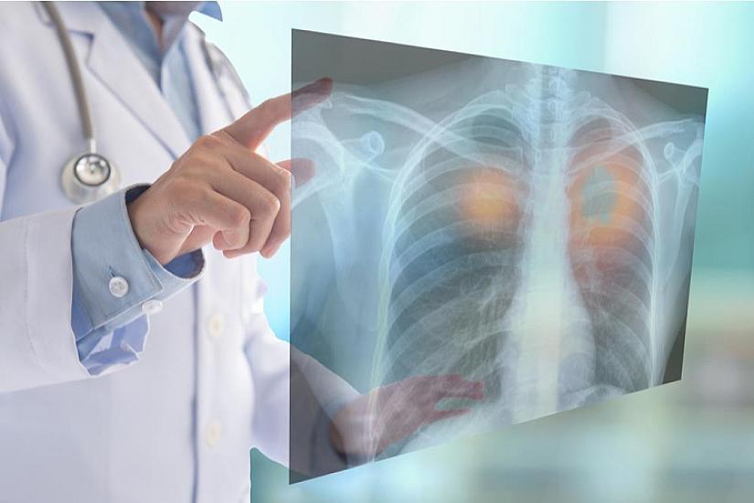 Harmless-looking habits are DANGEROUS for health