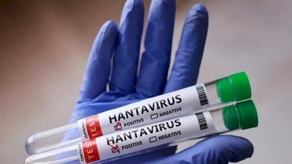 ÜST Azərbaycanda hantavirusa dair 