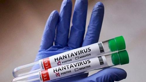ÜST Azərbaycanda hantavirusa dair 