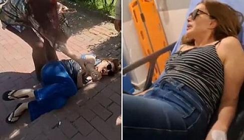 Keçmiş modelin ayağı qırıldı - Xəstəxanaya yerləşdirildi 