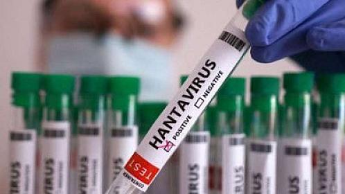 "Hantavirus"la bağlı 4 il əvvəl edilən paylaşım viral oldu - 