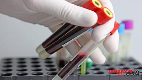 Hepatit B ilə bağlı  