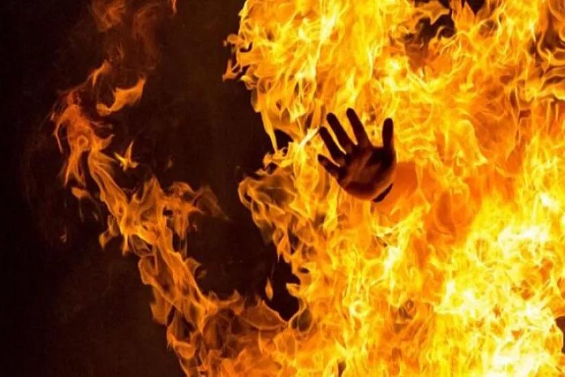 A man burned in Shirvan
