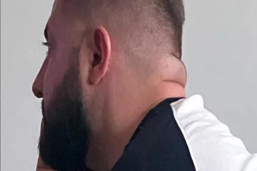 Boynunuzun qalın olması insult və diabet