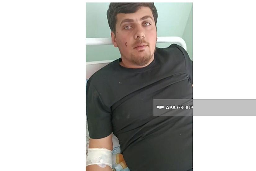 Dron hücumunda yaralanan Azərbaycan vətəndaşı: 