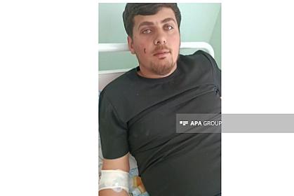 Dron hücumunda yaralanan Azərbaycan vətəndaşı: 