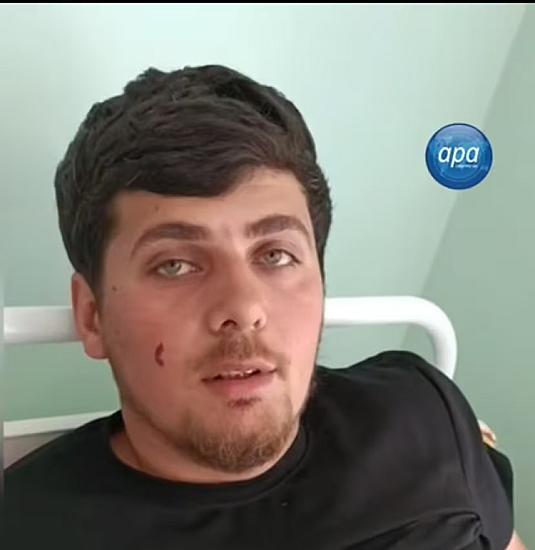 Dron hücumunda yaralanan vətəndaşımız danışdı 