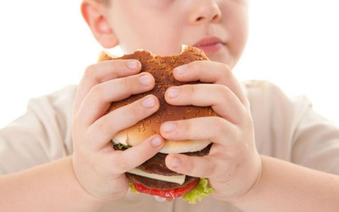 Obesity in children