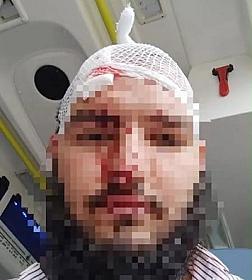 Varşavada azərbaycanlı sürücüyə hücum edildi - 